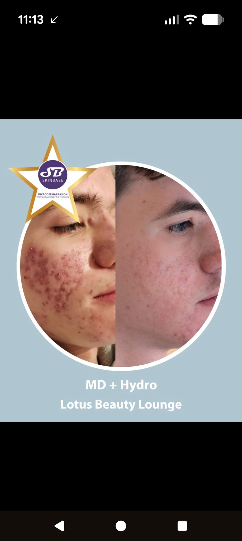 Harry - Transformation of the Year Winner