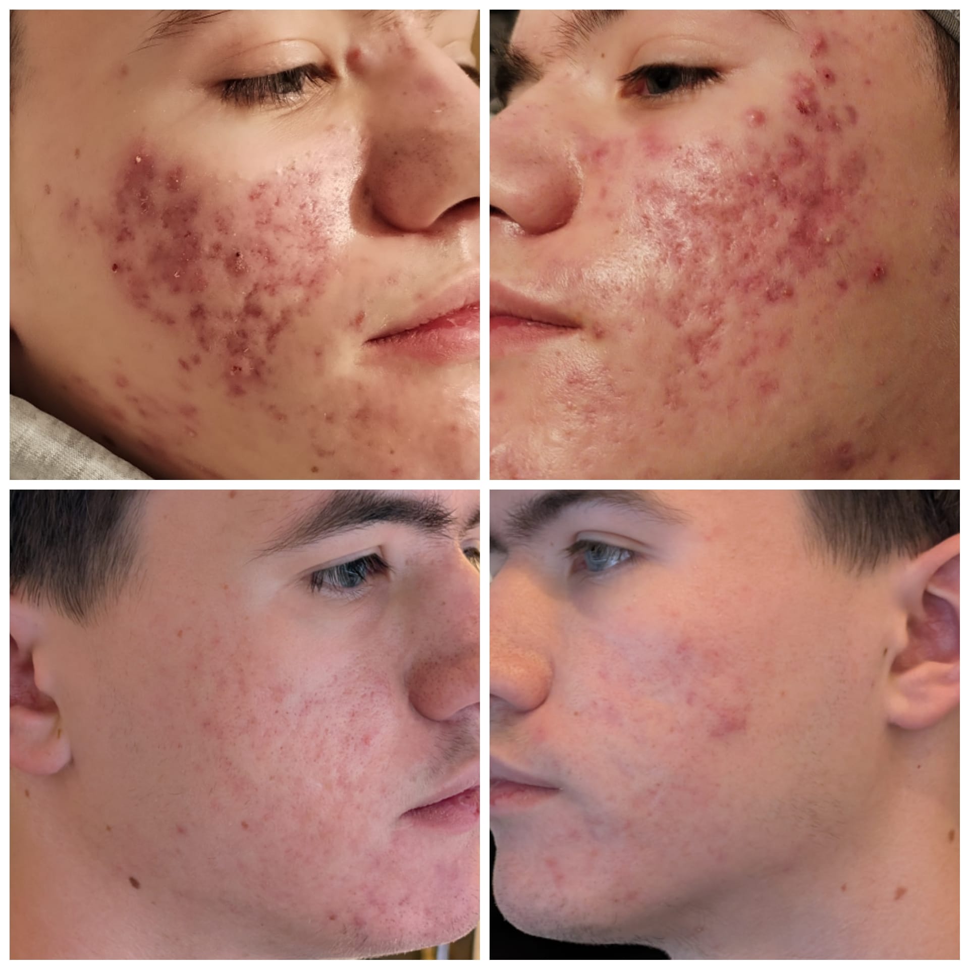 Facial Treatments